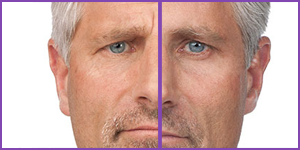 botox birmingham mi