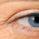 facial filler eye treatment birmingham, mi
