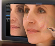 computer skin imaging troy mi