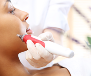 microdermabrasion