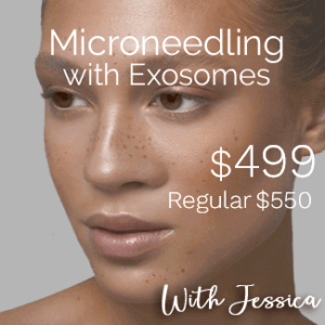 microneedling special