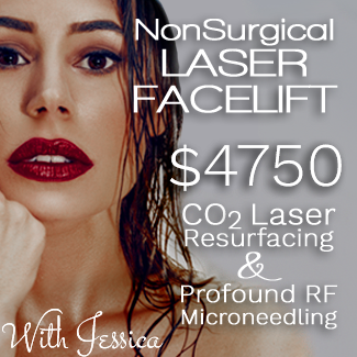laser facelift special birmingham mi